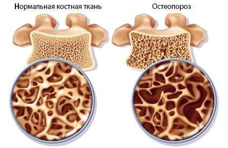 Bon-C — Бон-Си - 1